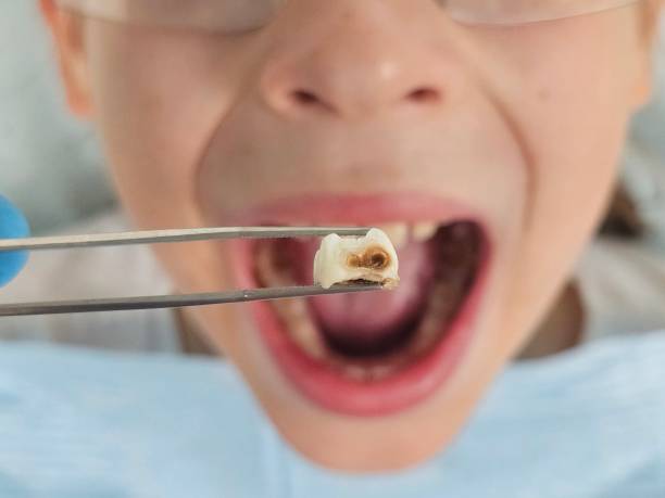 Best Emergency Gum Pain Relief  in Victoria, MN