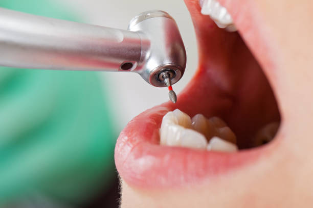 Best Cracked Tooth Emergency Dentist  in Victoria, MN